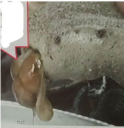 <p>What is being pointed to on this sea cucumber </p>