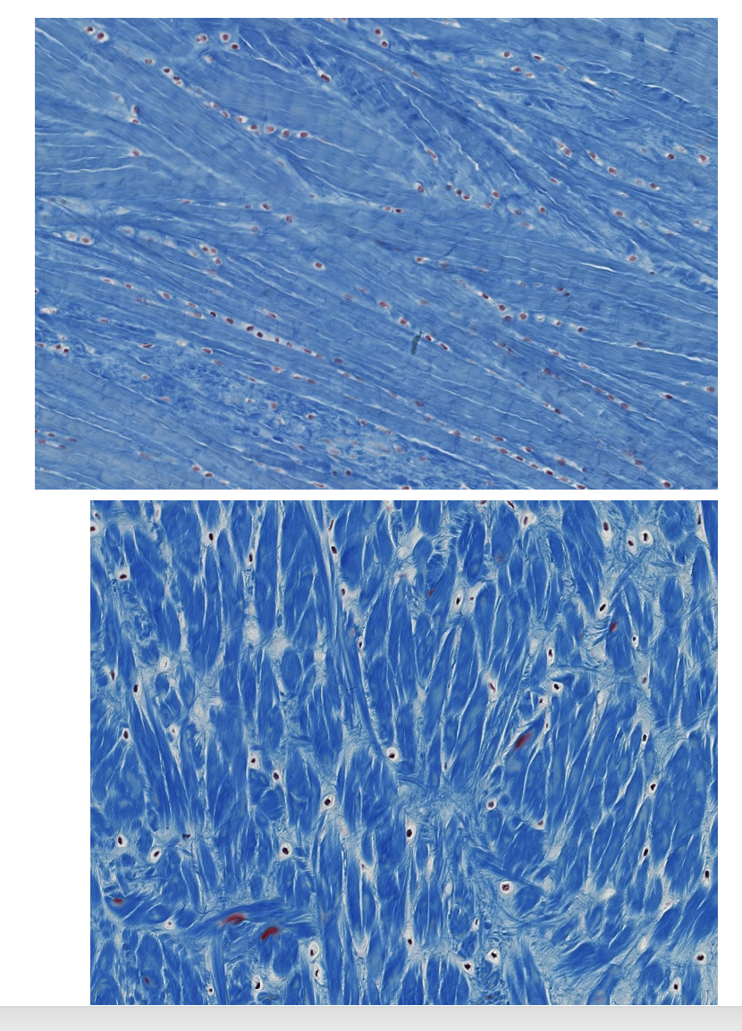 <p><span style="font-family: "Calibri Light";">Which type of CT is this?<br></span></p>