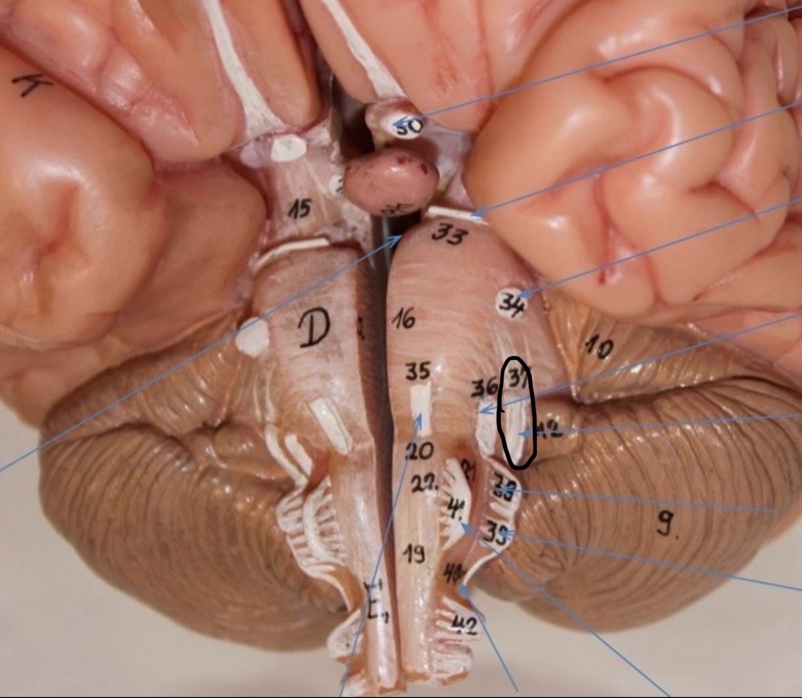 <p>Identify the circled area?</p>