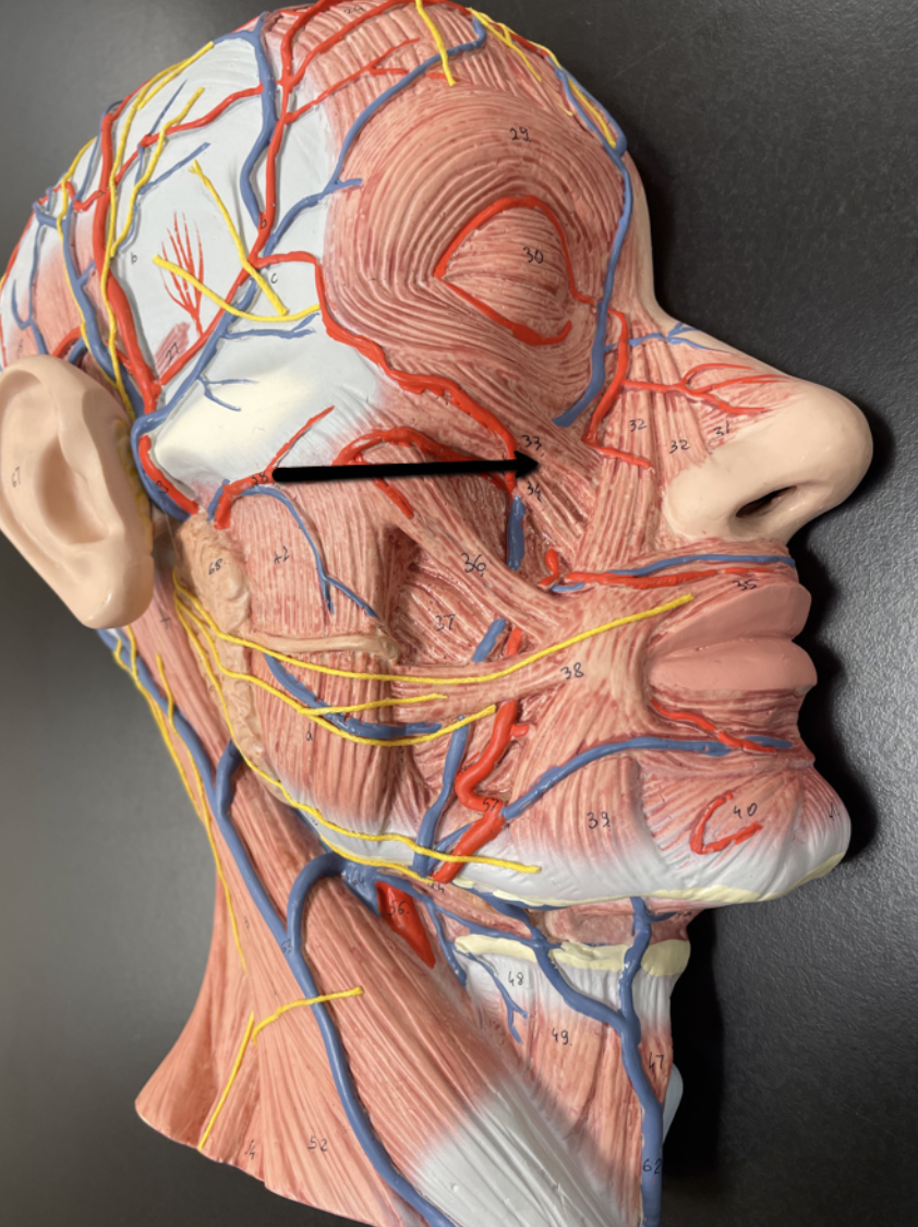 <p>Identify the muscle indicated by the pointer.</p>