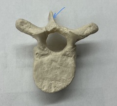 <p>What is the arrow pointing to?</p>