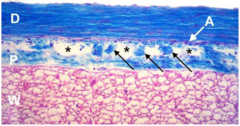 <p>- spider web appearance</p><p>- forms granulations that reabsorb CSF</p><p>- location of small arteries</p><p>- function = cushioning and absorption of CSF</p>