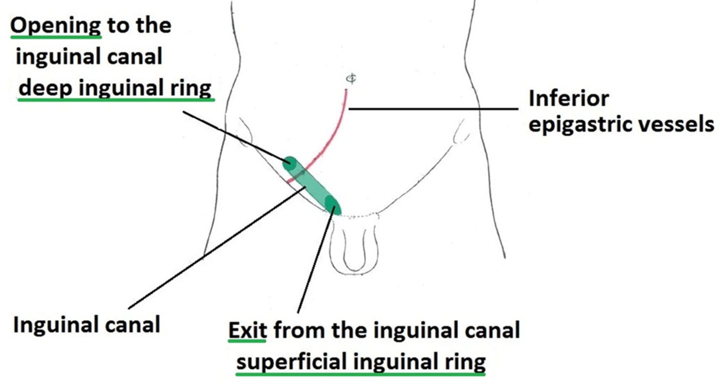 <p>deep inguinal ring - opening in transversalis fascia, entrance to inguinal canal (spermatic cord enters)</p><p>superficial inguinal ring - where spermatic cord exits to go to the scrotum/ round l. of uterus passes through</p>