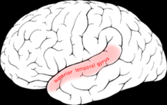 <p>language comprehension (temporal lobe)</p>