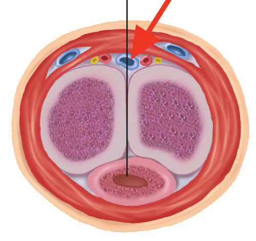 <p>deep vein on the dorsal side that drains blood from the penis</p>
