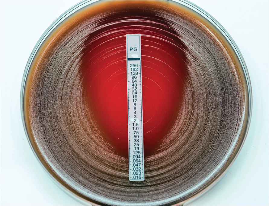 <p><mark data-color="yellow" style="background-color: yellow; color: inherit;">Modification of disk diffusion test that uses filter paper strips with a </mark><strong><mark data-color="yellow" style="background-color: yellow; color: inherit;">concentration gradient</mark></strong><mark data-color="yellow" style="background-color: yellow; color: inherit;"> of the antibiotic</mark></p><p>» zone of inhibition is tear-drop shaped (red in image); <mark data-color="yellow" style="background-color: yellow; color: inherit;">will line up with the strip at the conc. bacteria no longer grows</mark></p><p><mark data-color="yellow" style="background-color: yellow; color: inherit;">» where it ends = </mark><strong><mark data-color="purple" style="background-color: purple; color: inherit;">MIC</mark></strong></p><p></p>