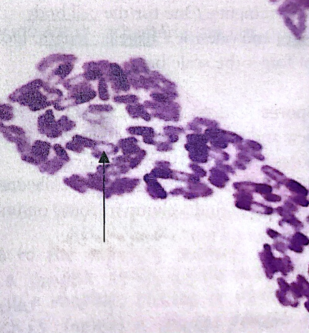 <p>a dormant extremely heat-resistant dehydrated structure </p><p>Resistant to chemicals and thus difficult to stain, as they are dehydrated and water-soluble dyes won't penetrate it</p>