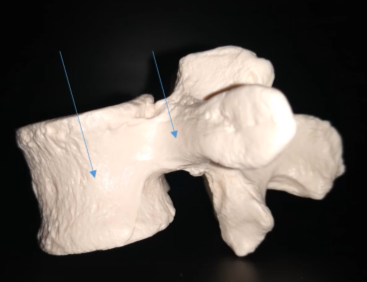 <p>What is this arrow pointing at on the right?</p>