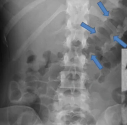 <p>diagnosis</p>