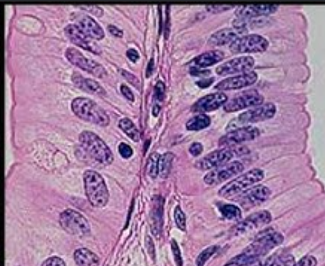 <p>simple columnar or simple squamous </p>