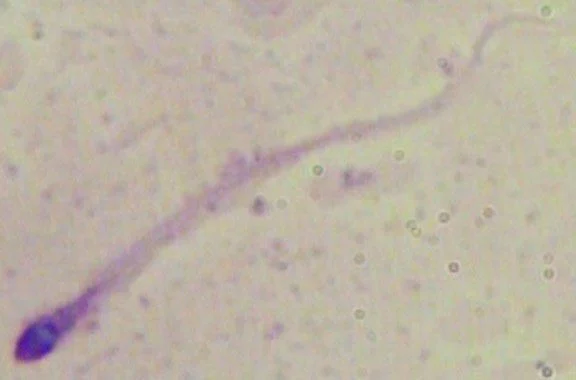 <p>Tapered sperm</p>