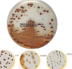 <p>Algemene bodem dat gebruikt wordt voor de isolatie van micro-organismen uit urine → semi-kwantitatieve beoordeling én directe identificatie van E. coli, Proteus en Enterococcus, en presumptieve identificatie van KESC (beter dan CLED-agar voor de isolatie van pathogenen uit urine)</p><p>Bevat tryptofaan en chromogene substraten</p><p><u>E. coli</u></p><ul><li><p>Beta-glucuronidase (of eventueel beta-galactosidase, zoals op UriSelect agar) → roze-bordeaux kolonies </p></li></ul><p><u>Proteus, Morganella, Providencia</u></p><ul><li><p>Tryptofaandeaminase → bruinverkleuring </p></li><li><p>Extra: indoltest → negatief = P. mirabilis, positief = P. vulgaris, Morganella of Providencia</p></li></ul><p><u>Enterococcus </u></p><ul><li><p>Beta-glucosidase → turquoise kolonies (grampositieve kokken) </p></li></ul><p><u>KESC </u></p><ul><li><p>Beta-glucosidase → groene tot bruingroene kolonies (gramnegatieve staven) </p></li></ul><p><u>Overige bacteriën </u></p><ul><li><p>Andere kleur/morfologie → minder typisch </p></li></ul><p></p>