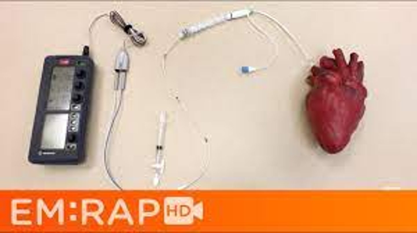<p>regulates heartbeat; limits mobility and can be life-threatening if disconnected</p>