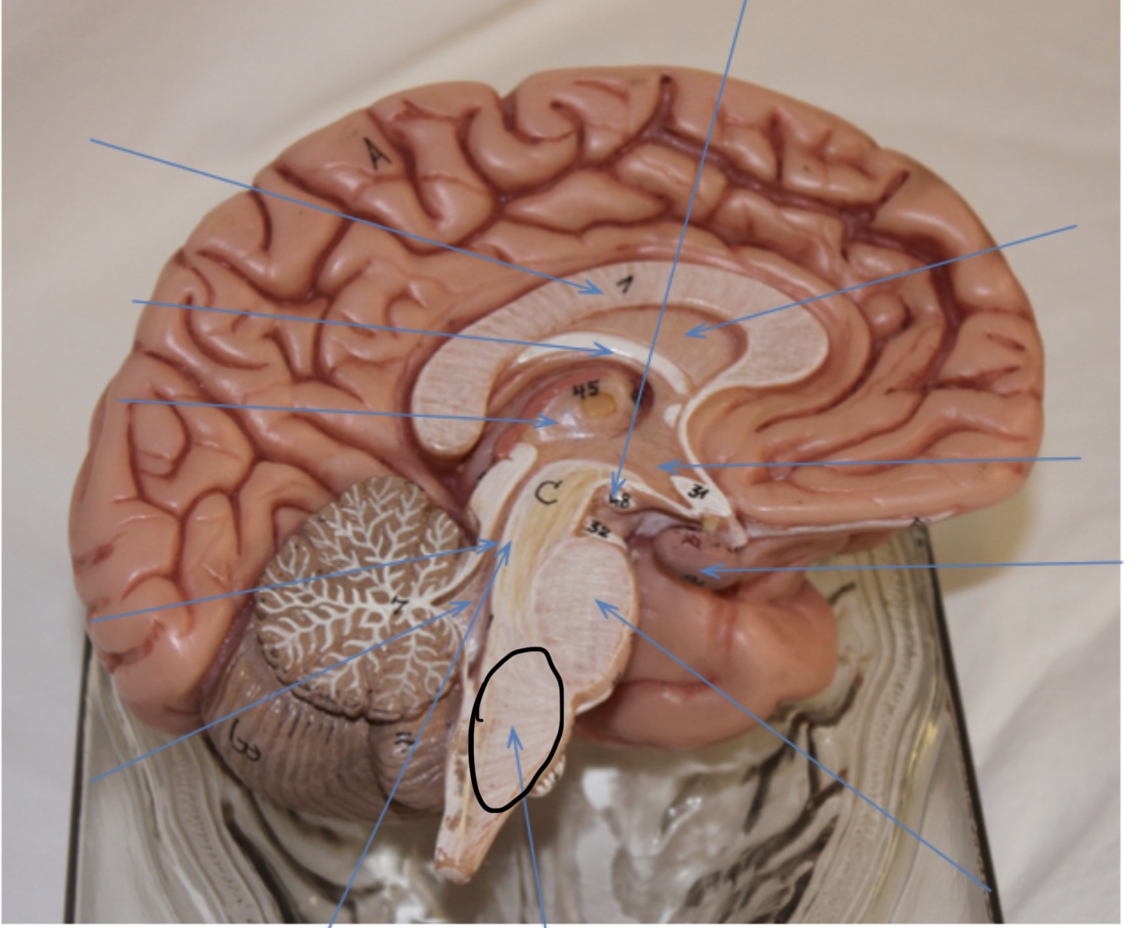 <p>Identify the circled area?</p>