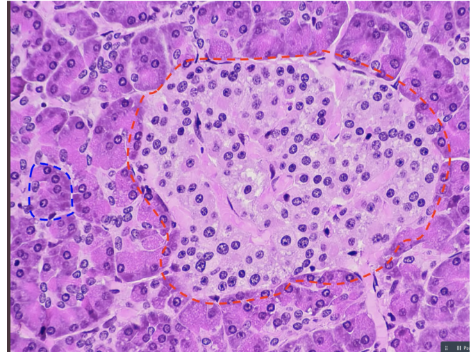 <p>what is blue </p>