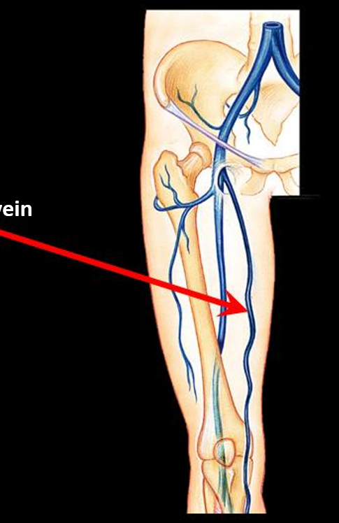 <p>Identify the vein?</p>