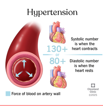 <p>What is Hypertension and its treatments?</p>
