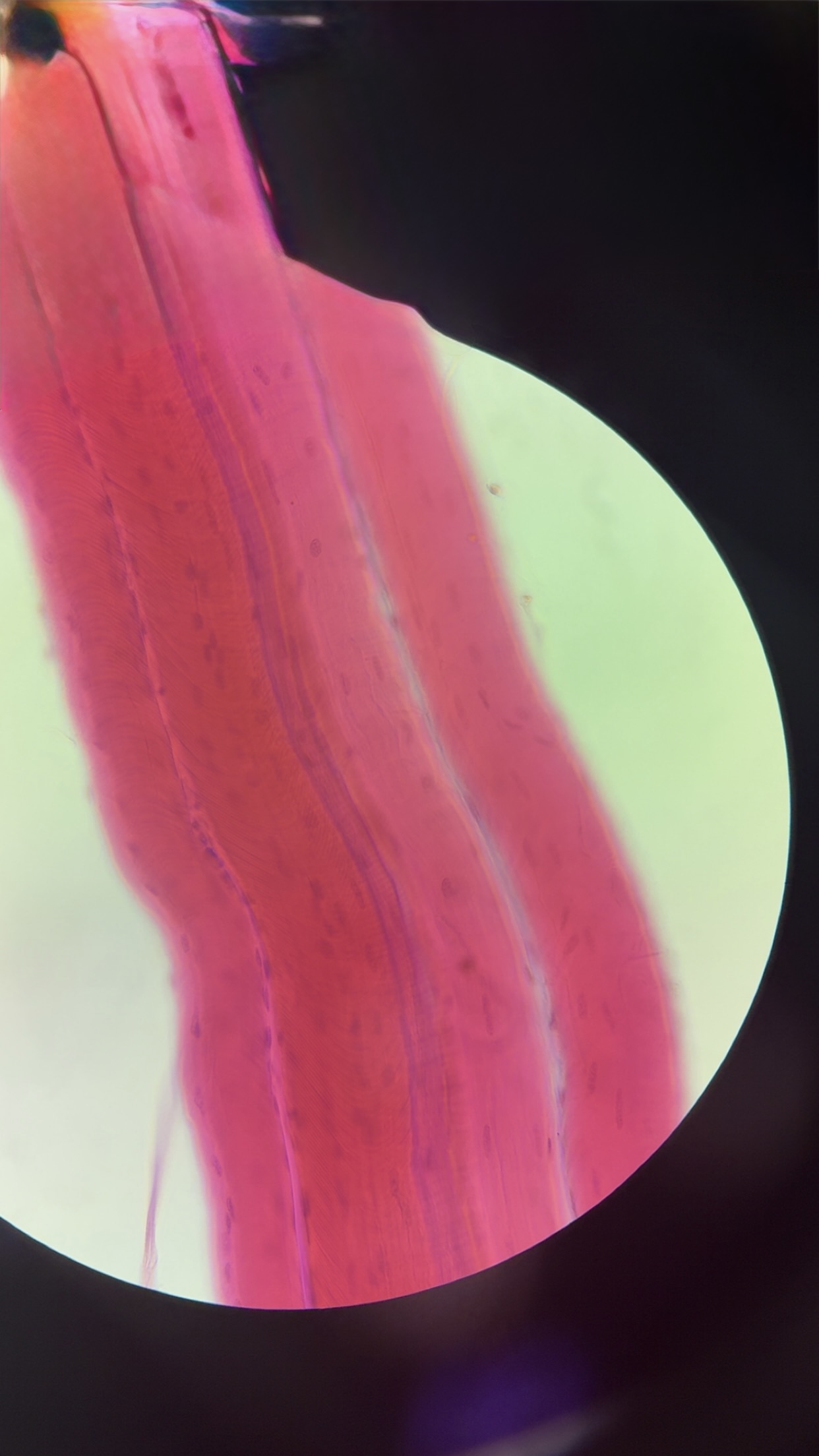 <p>what kind of muscle </p>
