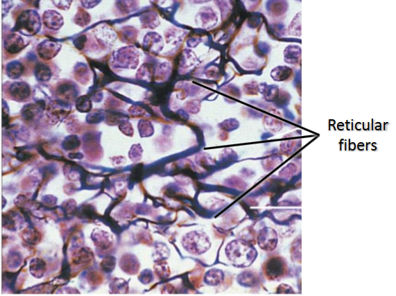 <p>Structure: scattered arrangement of reticular fibers</p><p>Function: supportive framework that holds other cells</p><p>Location: spleen, lymph nodes, thymus</p>