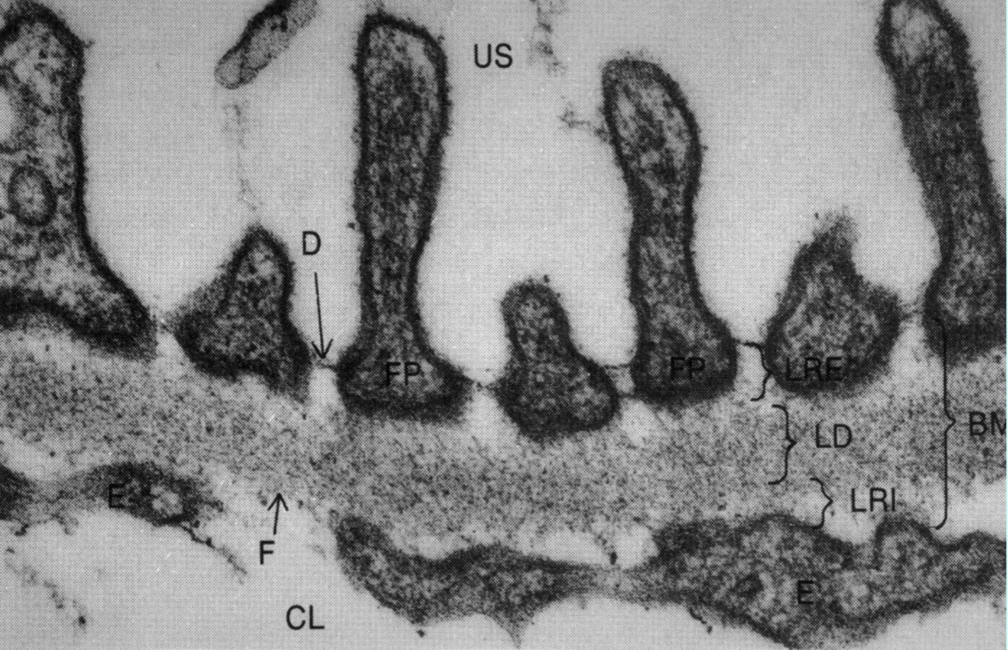 <p>Fenestrated capillary endothelium (CL), glomerular basement membrane (BM), &amp; podocytes (US)</p>