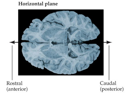 <p>divides brain into upper &amp; lower parts</p>