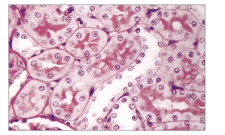 <p>Initial and straight area of return to the cortex (macula densa) presents</p><p>columnar epithelium and packed cells</p>