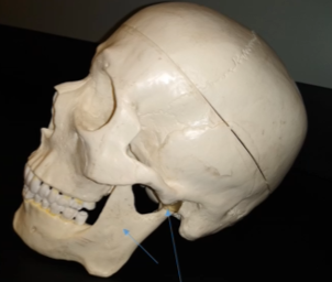 <p>What is this bone? (lower part of the jaw)</p>