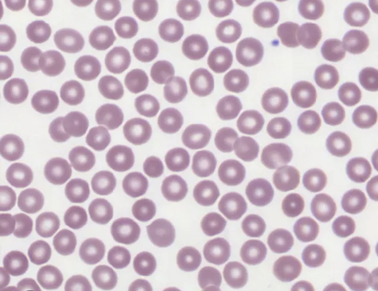 <p>Identify blood component </p>