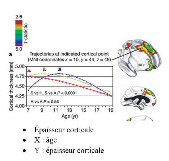 <p><span style="font-family: "Courier New"; line-height: 107%;">o</span><span style="font-family: "Times New Roman"; line-height: normal; font-size: 7pt;">&nbsp;&nbsp; </span><span style="font-family: "Times New Roman", serif; line-height: 107%;">Bleu&nbsp;: QI supérieur</span></p><p class="MsoListParagraph"><span style="line-height: 107%;">§</span><span style="font-family: "Times New Roman"; line-height: normal; font-size: 7pt;">&nbsp; </span><span style="font-family: "Times New Roman", serif; line-height: 107%;">Au départ&nbsp;: cortex + mince (- épais)</span></p><p class="MsoListParagraph"><span style="line-height: 107%;">§</span><span style="font-family: "Times New Roman"; line-height: normal; font-size: 7pt;">&nbsp; </span><span style="font-family: "Times New Roman", serif; line-height: 107%;">Avec le temps&nbsp;: épaisseur augmente jusqu’à 11 ans</span></p><p class="MsoListParagraph"><span style="line-height: 107%;">§</span><span style="font-family: "Times New Roman"; line-height: normal; font-size: 7pt;">&nbsp; </span><span style="font-family: "Times New Roman", serif; line-height: 107%;">11 ans&nbsp;et +&nbsp;: épaisseur diminue</span></p><p class="MsoListParagraph"></p><p class="MsoListParagraph"><span style="font-family: "Courier New"; line-height: 107%;">o</span><span style="font-family: "Times New Roman"; line-height: normal; font-size: 7pt;">&nbsp;&nbsp; </span><span style="font-family: "Times New Roman", serif; line-height: 107%;">Jaune&nbsp;: haute</span></p><p class="MsoListParagraph"></p><p class="MsoListParagraph"><span style="font-family: "Courier New"; line-height: 107%;">o</span><span style="font-family: "Times New Roman"; line-height: normal; font-size: 7pt;">&nbsp;&nbsp; </span><span style="font-family: "Times New Roman", serif; line-height: 107%;">Rouge&nbsp;: QI moyen</span></p><p class="MsoListParagraph"><span style="line-height: 107%;">§</span><span style="font-family: "Times New Roman"; line-height: normal; font-size: 7pt;">&nbsp; </span><span style="font-family: "Times New Roman", serif; line-height: 107%;">Diminution avec le temps</span></p><p class="MsoListParagraph"><span style="line-height: 107%;">§</span><span style="font-family: "Times New Roman"; line-height: normal; font-size: 7pt;">&nbsp; </span><span style="font-family: "Times New Roman", serif; line-height: 107%;">Épaisseur + grande au début (comparé à supérieure), mais diminue</span></p>