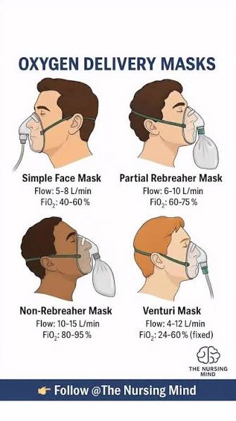 <p><span>A type of mask used to deliver high-flow oxygen; it allows some exhaled air to be re-inhaled.</span></p>