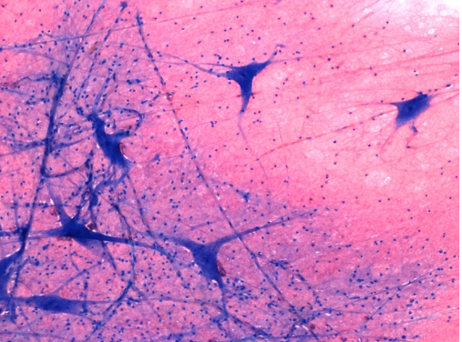 <p>What tissue is this?</p>