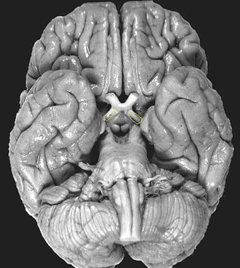 <p>What is the area highlighted called?</p>