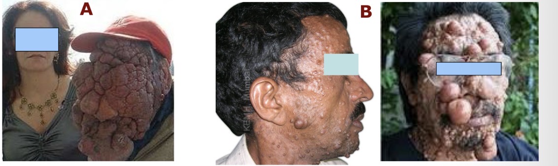 <p>B</p>