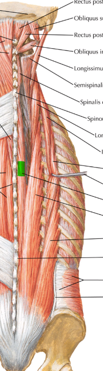 <p>Extension and lateral flexion of the vertebral column. Epaxial (dorsal root of spinal nerves). Most medial of the three (nearest the vertebral column), best for sagital plane movement</p><p>Capitis branch (head): spinous process of C7-T1 → occipital bone (proturburance)</p><p>Colli branch (neck): Spinous process of C7-T2 → spinous process of C2-C4</p><p>Thoracic branch: Spinous process of T11-L2 → Spinous process of T2-T8</p>