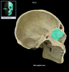 <p>Which skull bone is shown?</p>