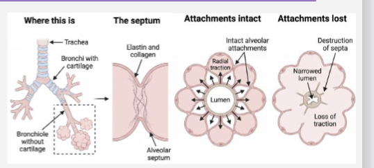<p><span>1 The structure:<br><strong>• Septum </strong>— the wall shared by two alveoli<br>•<strong> Elastin</strong> · collagen — the scaffold<br><strong>• Alveolar attachments </strong>— septa insert into the airway wall</span></p>
