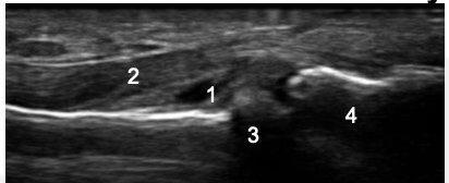 <p>What is the abnormality? </p>