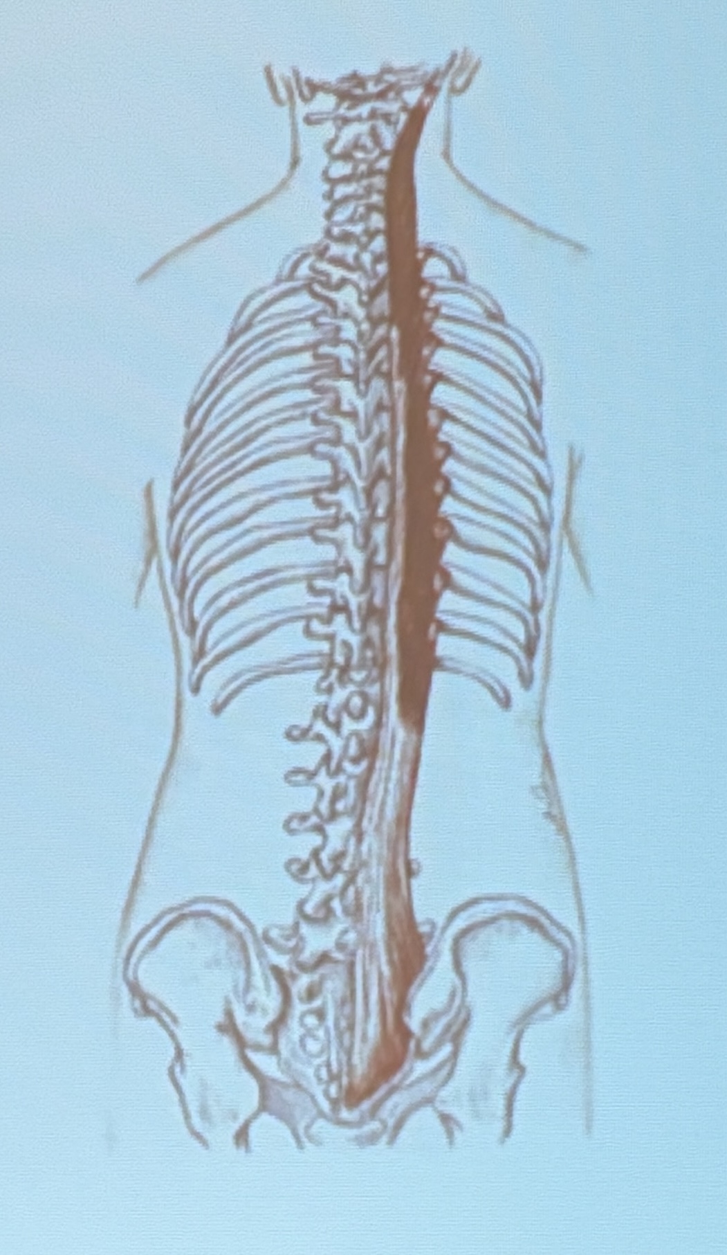 <p>Muscle name?</p>