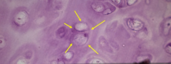 <p>What are the yellow arrows pointing to?</p>