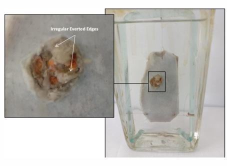 <p></p><p>Questions</p><ol><li><p>What is the specimen being examined?</p></li><li><p>What are the specific descriptive features of the wound edges and diameter?</p></li><li><p>How is the antemortem nature of this injury determined?</p></li><li><p>What type of causative instrument produced this injury?</p></li><li><p>How is the time of death estimated?</p></li><li><p>What are the possible causes of death?</p></li><li><p>What is the final diagnosis?</p></li></ol><div data-type="horizontalRule"><hr></div><p></p>