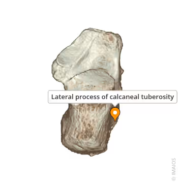 <p>What bone landmark within Calcaneus</p>