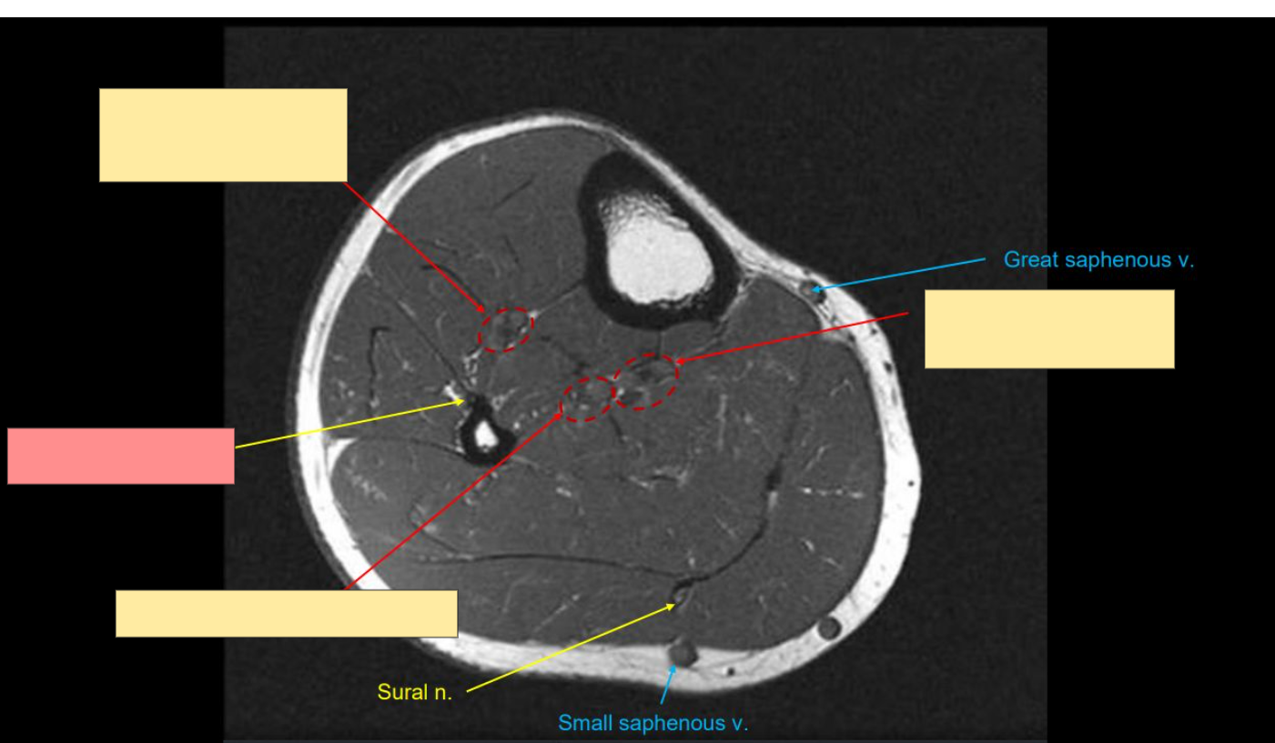<p>Identify the structure</p>