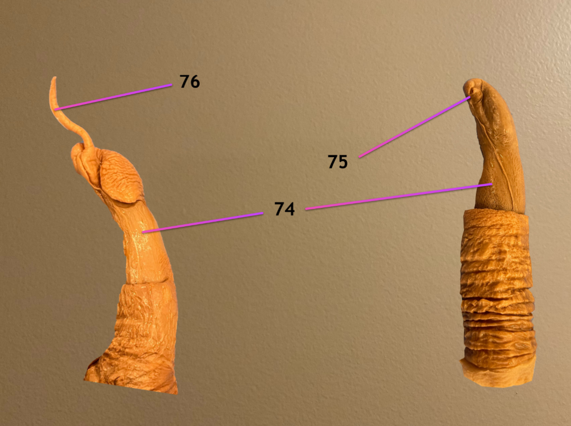 <p>view of glans penis</p><p>.</p><p>label &amp; note the species: 75, 76</p>