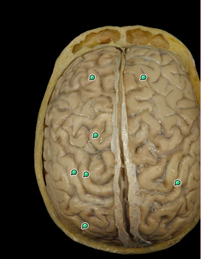 <p>Identify right and left cerebral hemispheres</p>