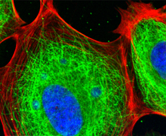 <p>A network of long protein strands in the cytosol that helps support the cell shape</p>