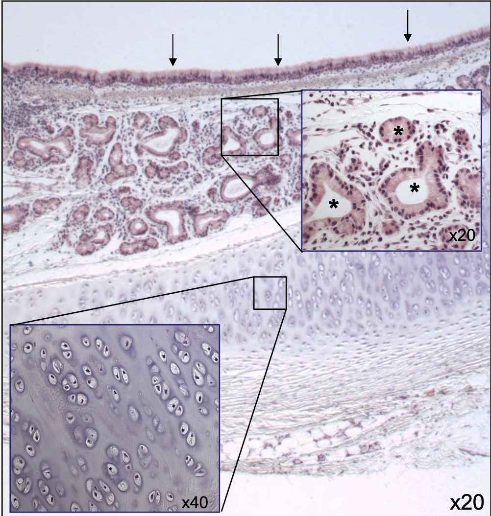 <p>what are the black arrows pointing at? </p>