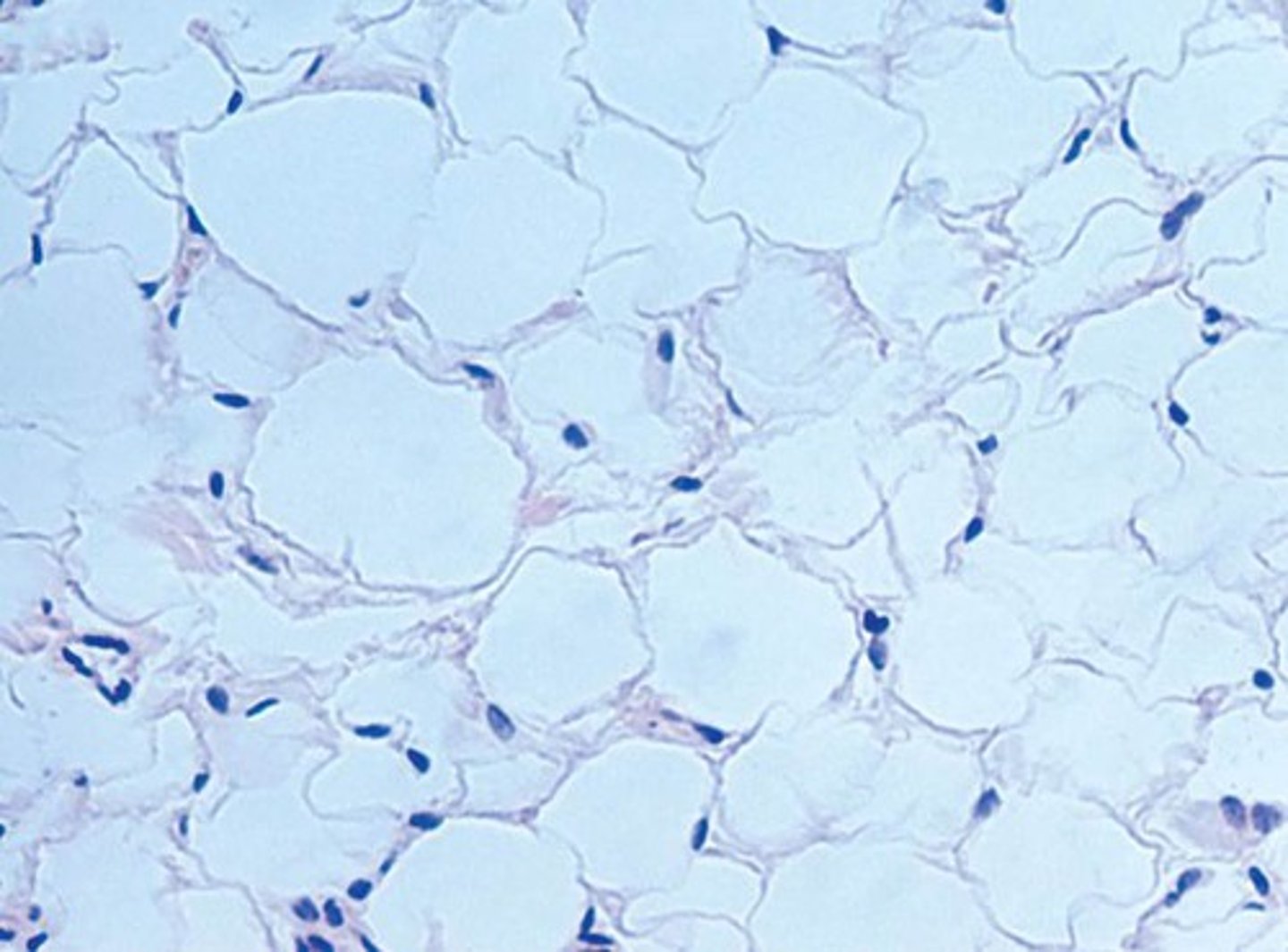 <p>type of tissue?</p>