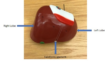 <p>left lobe, falciform ligament, right lobe</p>
