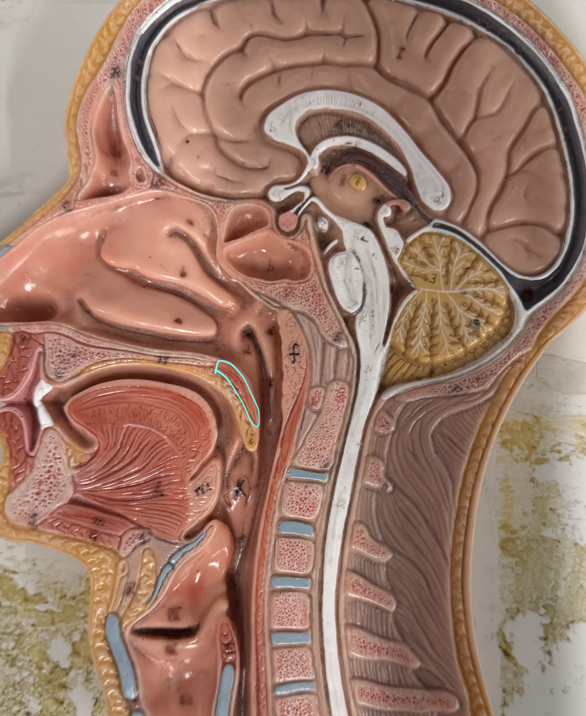 <p>Muscular </p><p>forms root of oral cavity + plays an important role in swallowing</p>