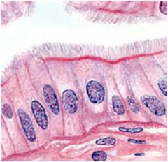 <p><span>epithelium contains cells with cilia, motile, hair-like processes that help to move fluids or particles along a surface. Most often seen in fallopian tubes and bronchioles.</span></p>